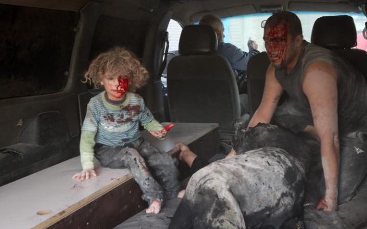 A wounded Syrian child looks on from inside a vehicle following a reported airstrike on Kafr Batna in the outskirts of the capital Damascus CREDIT: AMER ALMOHIBANY/AFP